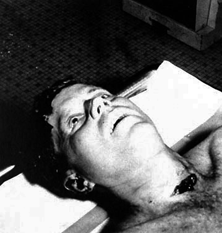 JFK AUTOPSY SECRETS REVEALED!